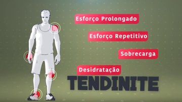 Vídeo: Veja como prevenir inflamações causadas pela má postura no Almanaque Saúde