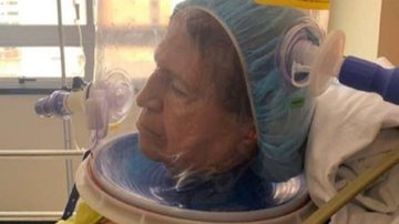 Paciente usa capacete produzido por SENAI do Ceará durante tratamento e recebe alta