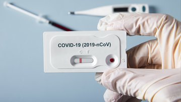 SESI oferecerá testes rápidos de Covid-19 para indústrias