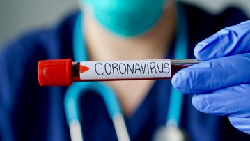A indústria contra o coronavírus: vamos juntos superar essa crise
