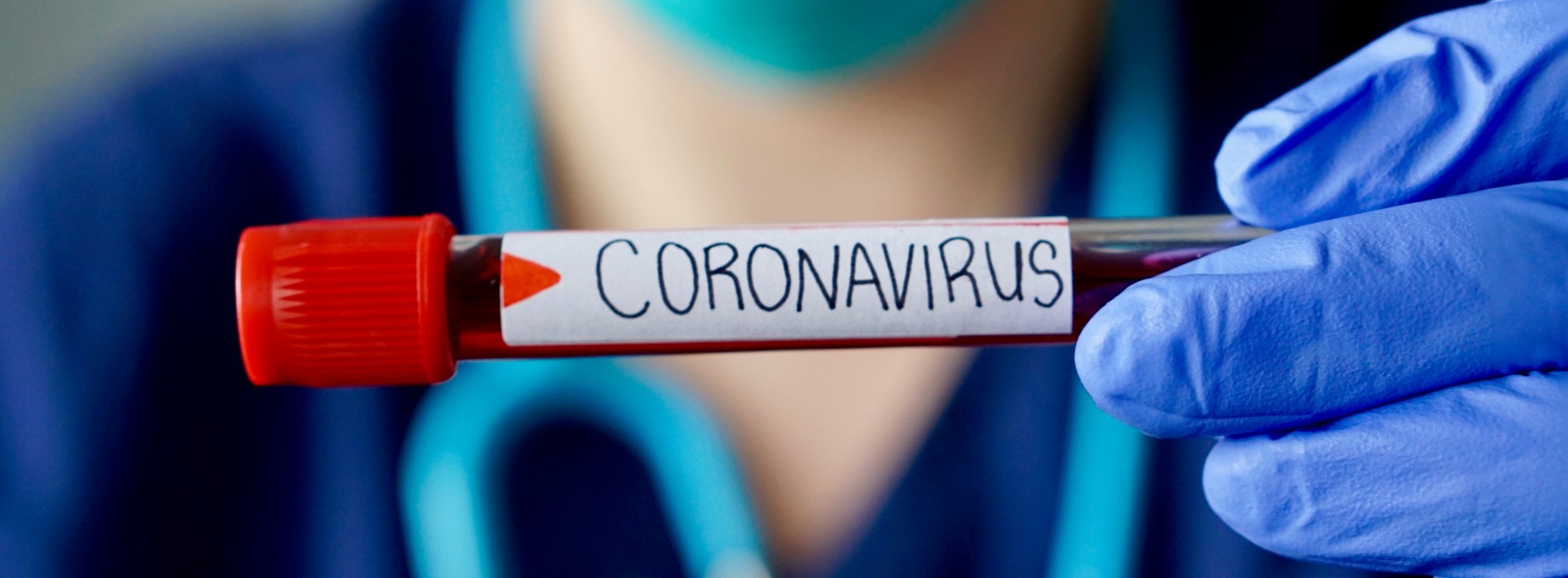 Pandemia de coronavírus está adiando eventos e festas para o segundo  semestre em Caxias Sul